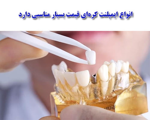 انواع ایمپلنت کره ای دارای مجوز fda اروپا هستند.