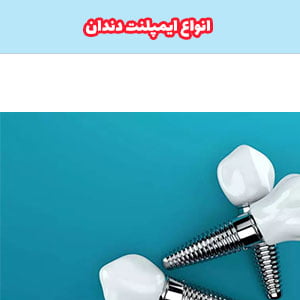 انواع ایمپلنت دندان؛ انواع برندها ایمپلنت