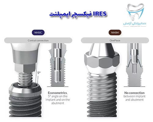 فیکسچر ایمپلنت IRES یکی از بهترین فیکسچر های جهان می‌باشد.